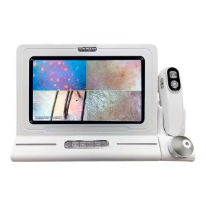 Analizador Cuero Cabelludo Mesa A2